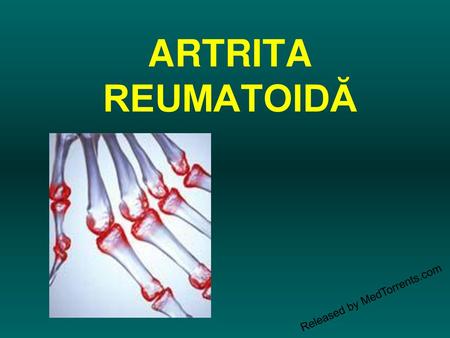 ARTRITA REUMATOIDĂ Released by MedTorrents.com.