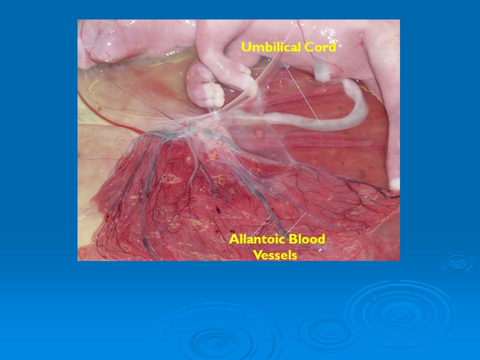Umbilical Cord Allantoic Blood Vessels