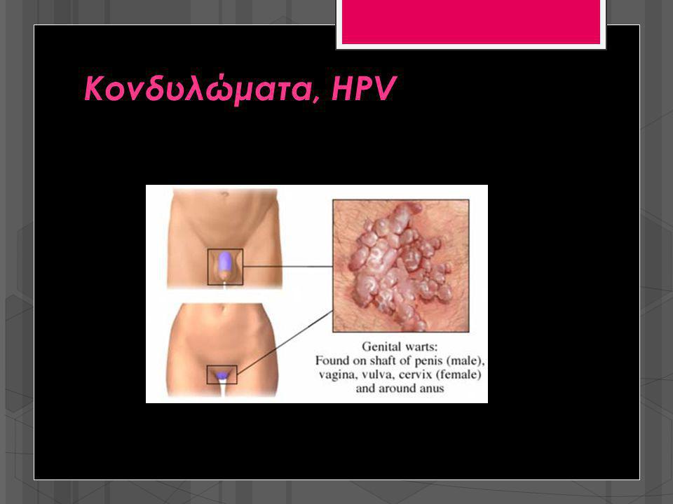 Κονδυλώματα, HPV
