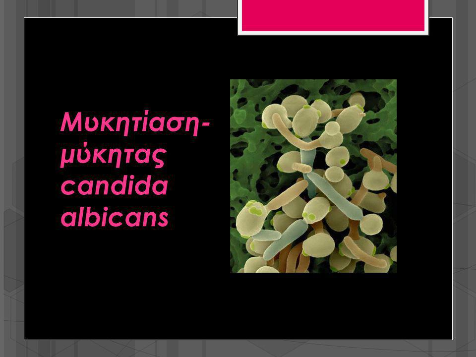 Μυκητίαση- μύκητας candida albicans