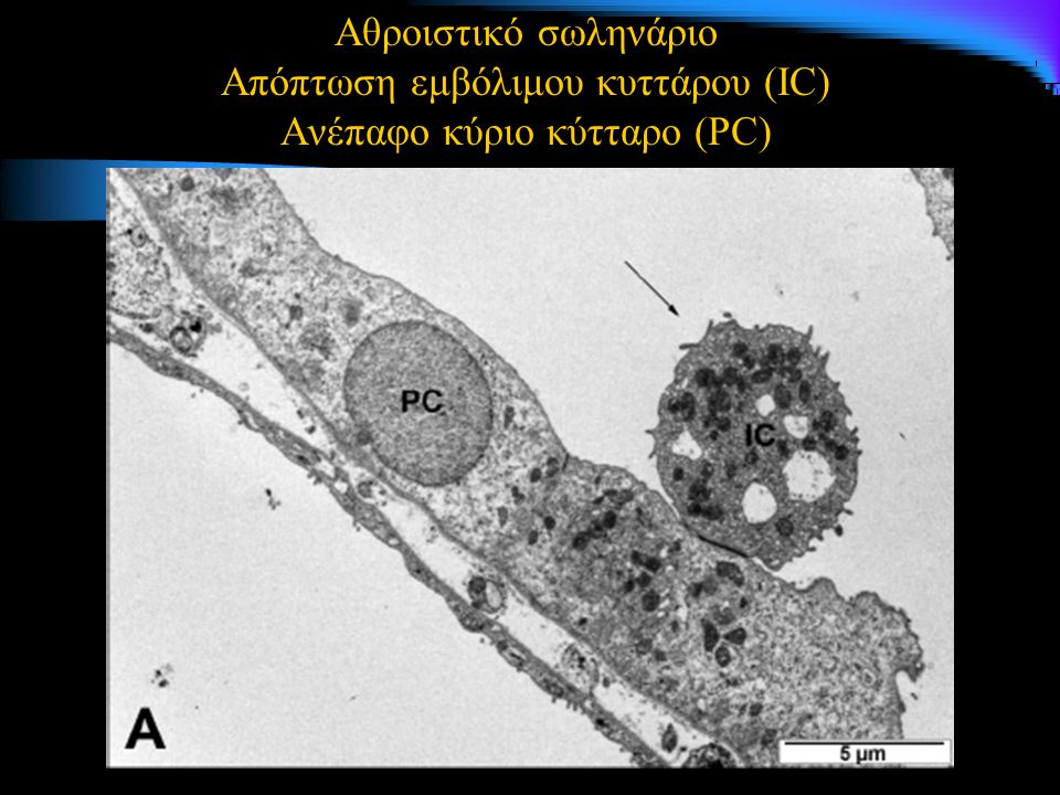 Αθροιστικό σωληνάριο Απόπτωση εμβόλιμου κυττάρου (IC) Ανέπαφο κύριο κύτταρο (PC)