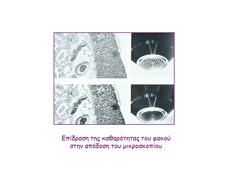 Επίδραση της καθαρότητας του φακού στην απόδοση του μικροσκοπίου