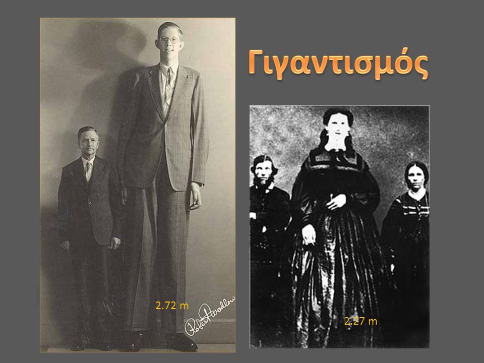 Γιγαντισμός Robert Wadlow, the tallest man known to have lived (2.72 metres) with his father, Harold Wadlow (1.82 metres)