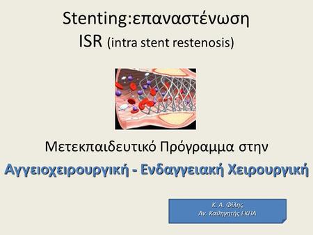 Stenting:επαναστένωση ISR (intra stent restenosis)