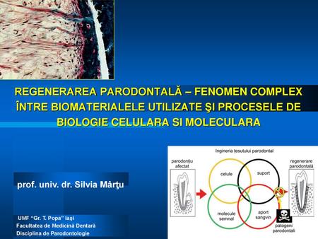 REGENERAREA PARODONTALĂ – FENOMEN COMPLEX ÎNTRE BIOMATERIALELE UTILIZATE ŞI PROCESELE DE BIOLOGIE CELULARA SI MOLECULARA prof. univ. dr. Silvia Mârţu UMF.