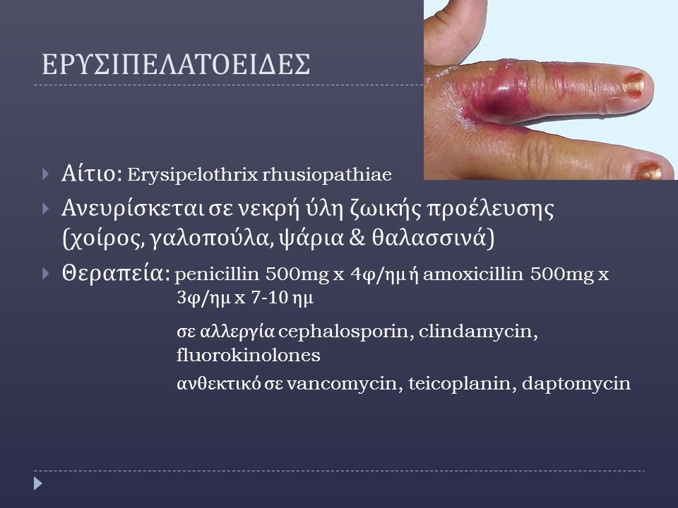 ΕΡΥΣΙΠΕΛΑΤΟΕΙΔΕΣ Αίτιο: Erysipelothrix rhusiopathiae
