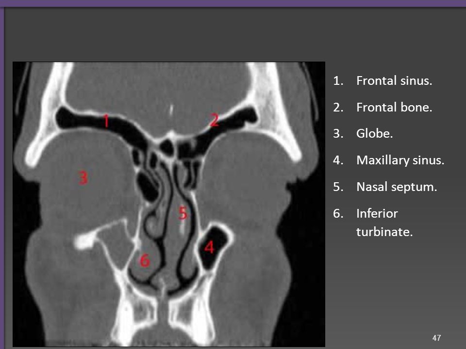 Frontal sinus. Nasal bone. Nasal cavity. Alveolar arch.
