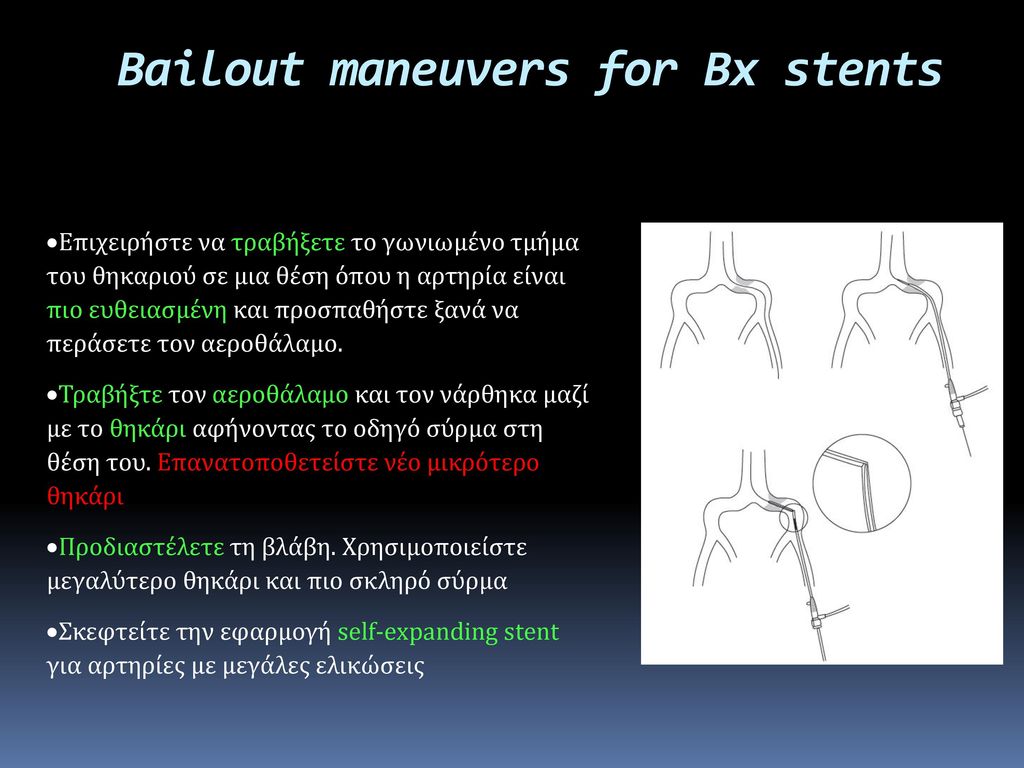 Bailout maneuvers for Bx stents