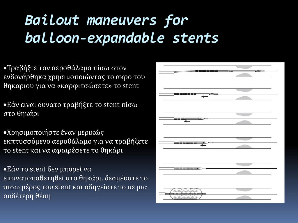 Bailout maneuvers for balloon-expandable stents
