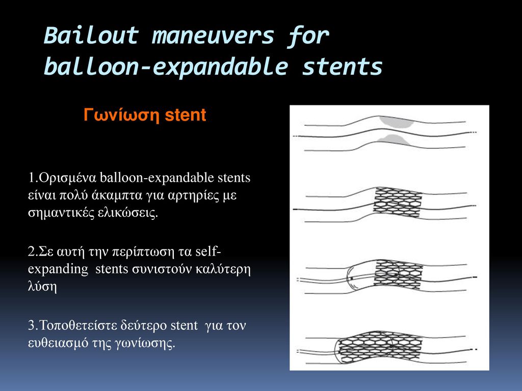 Bailout maneuvers for balloon-expandable stents