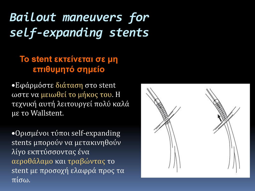 Bailout maneuvers for self-expanding stents