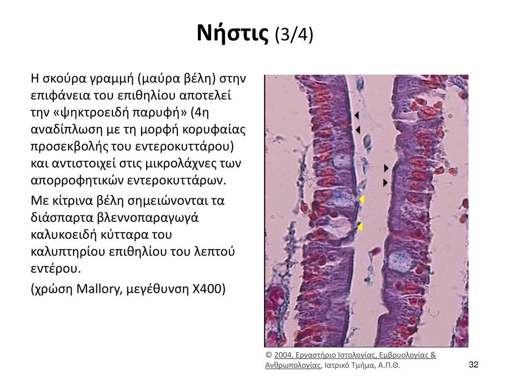 Νήστις (4/4) Ιστολογική εικόνα νήστιδας σε μικρή μεγέθυνση (4x). Από τα αριστερά προς τα δεξιά παρατηρούνται: