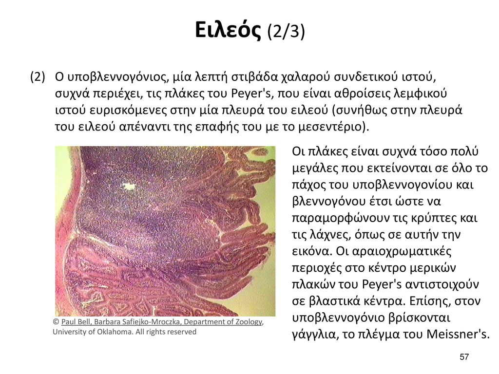 Ειλεός (3/3) Ο μυϊκός χιτώνας, αποτελούμενος από μία έσω κυκλοτερή και μία έξω επιμήκη στιβάδα λείου μυϊκού ιστού.