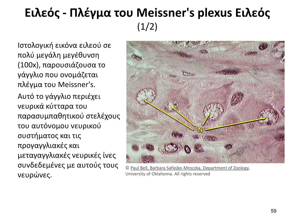 Ειλεός - Πλέγμα του Meissner s plexus Ειλεός (2/2)