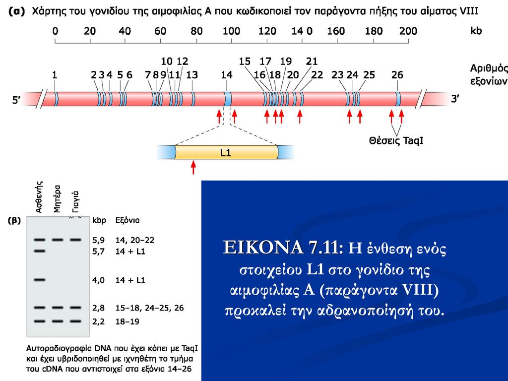 ΕΙΚΟΝΑ 7.11: Η ένθεση ενός στοιχείου L1 στο γονίδιο της αιμοφιλίας Α (παράγοντα VΙΙΙ) προκαλεί την αδρανοποίησή του.