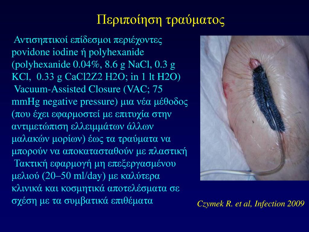 Czymek R. et al, Infection 2009