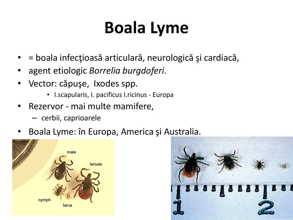 Boala Lyme = boala infecţioasă articulară, neurologică şi cardiacă,