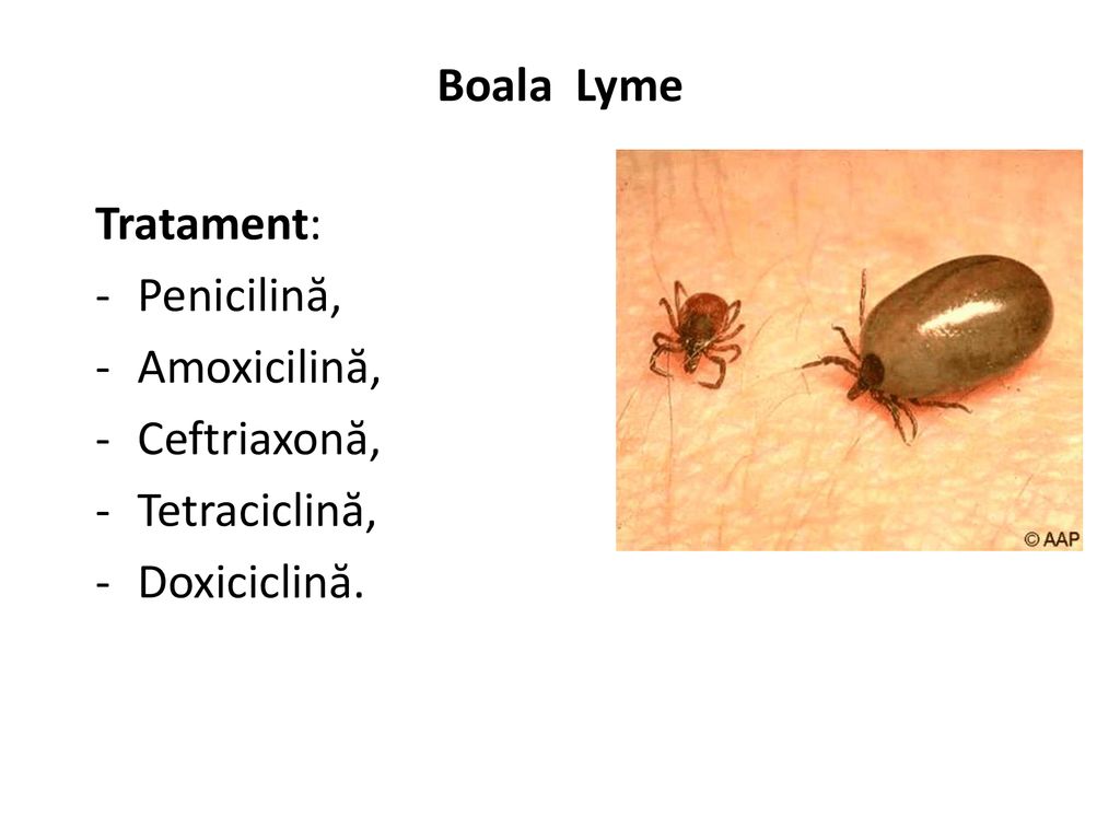 Boala Lyme Tratament: Penicilină, Amoxicilină, Ceftriaxonă, Tetraciclină, Doxiciclină.