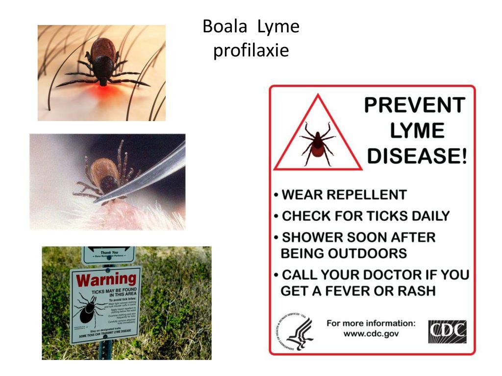 Boala Lyme profilaxie