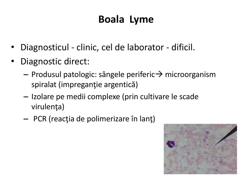 Boala Lyme Diagnosticul - clinic, cel de laborator - dificil.
