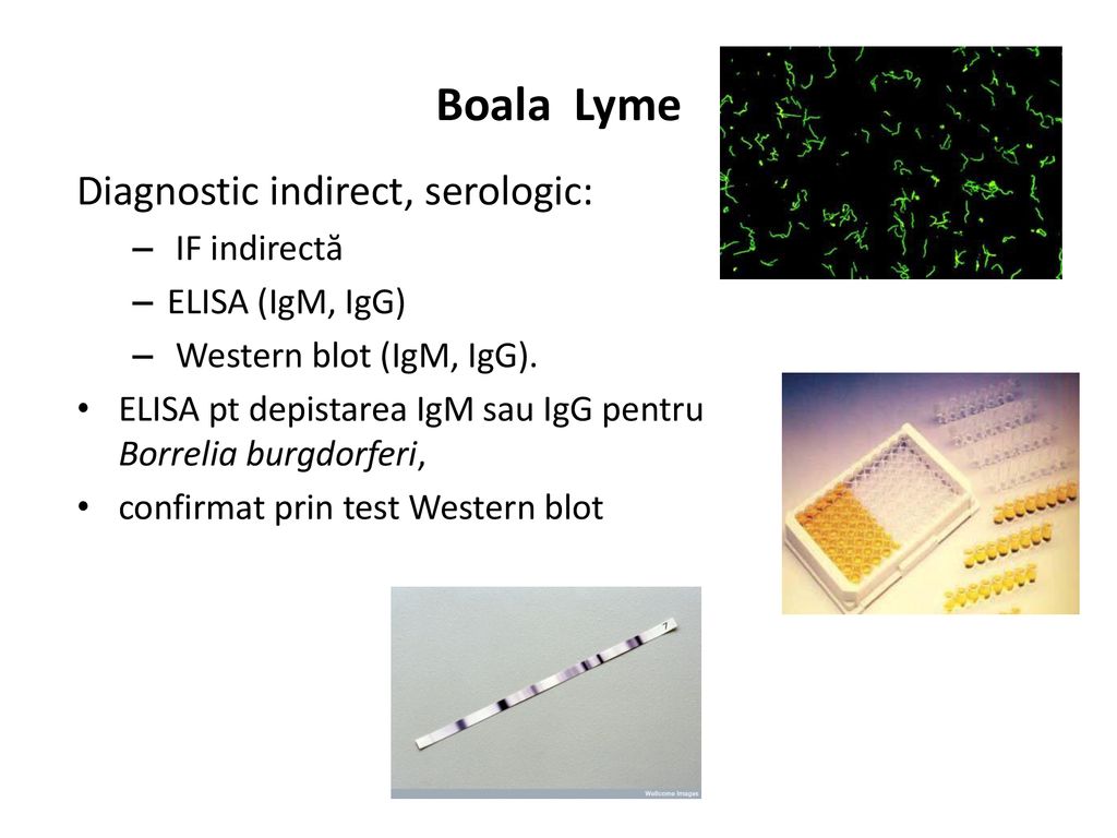 Boala Lyme Diagnostic indirect, serologic: IF indirectă