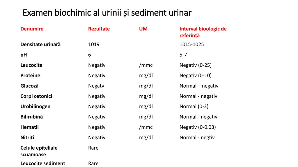 ionograma urinara)