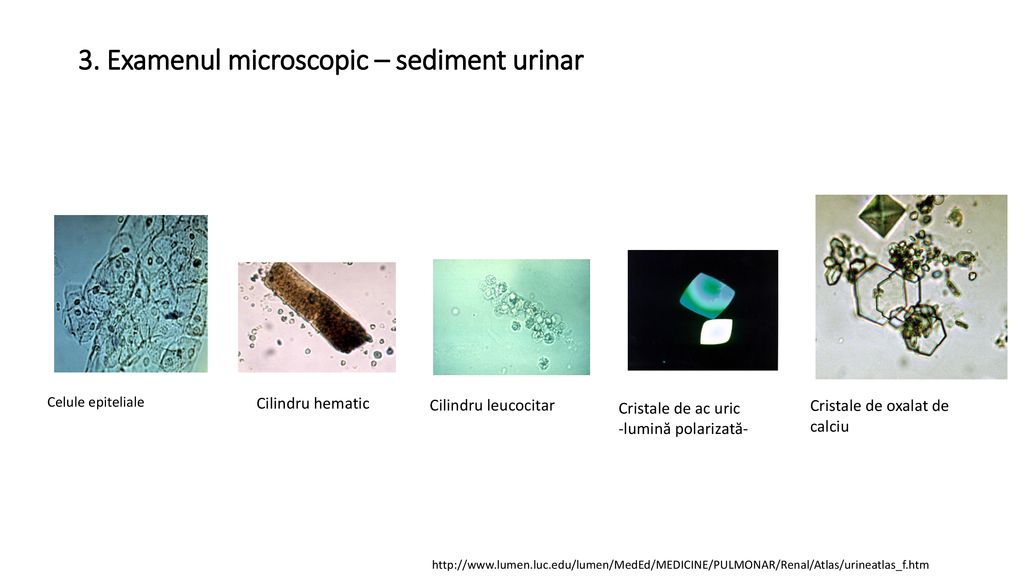 sediment urinar rare epitelii plate rar mucus