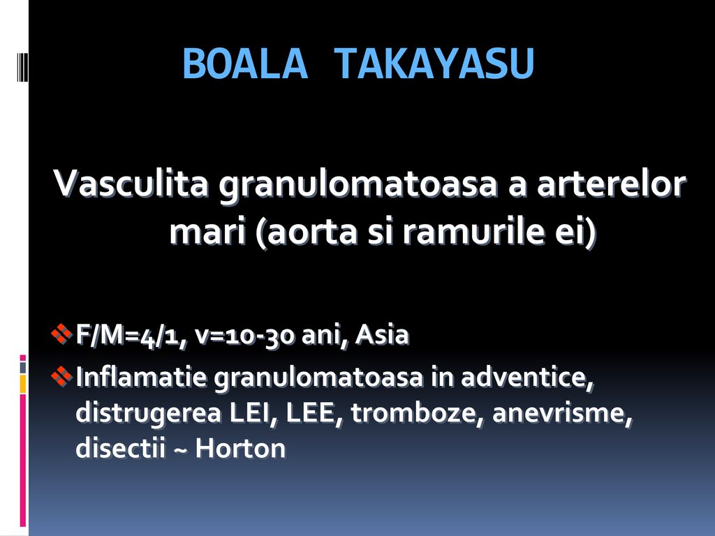 Aoroarterita nespecifică (boala Takayasu)