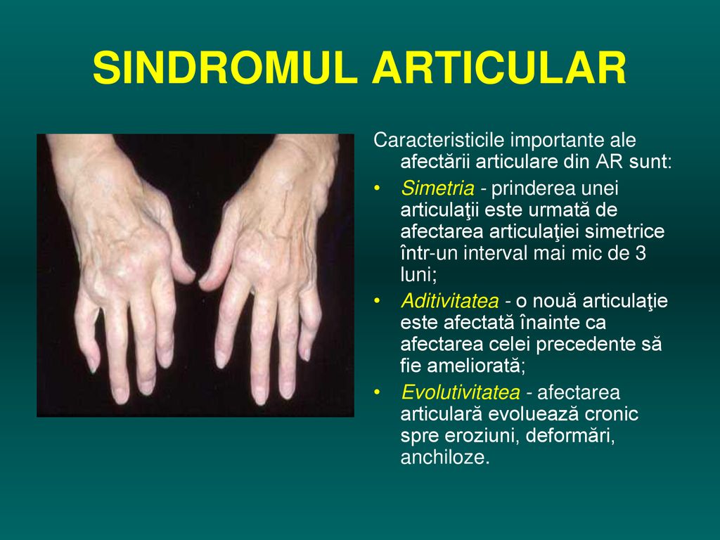 Reumatologia si bolile reumatice, Artrita articulațiilor cartilajului laringelui