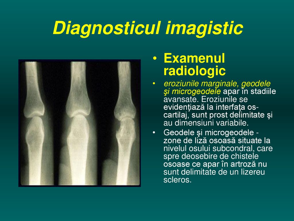 semne radiologice ale bolilor osoase și articulare