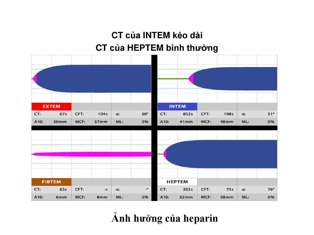 CT của HEPTEM bình thường