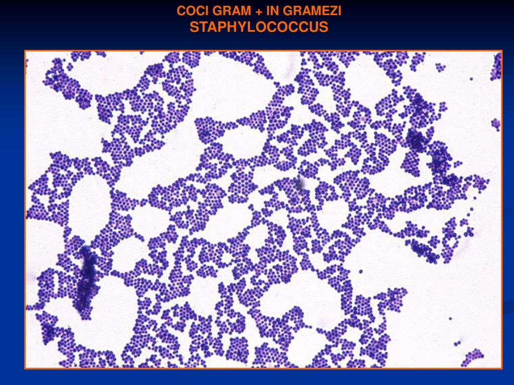 Staphylococcus aureus 5. Стафилококк микроскопия. Стафилококк в микроскопе. Staphylococcus epidermidis под микроскопом. Стафилококк ауреус морфология.