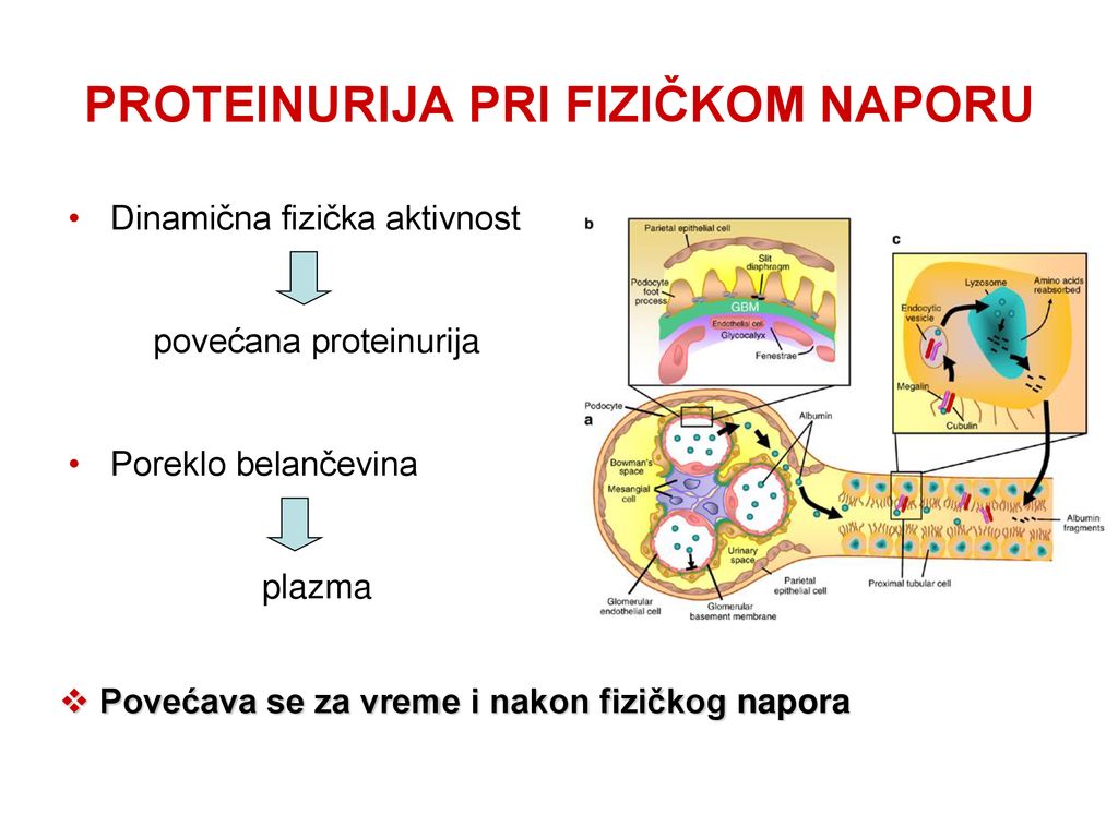 PROTEINURIJA INDUKOVANA FIZIČKIM NAPOROM - Ppt κατέβασμα