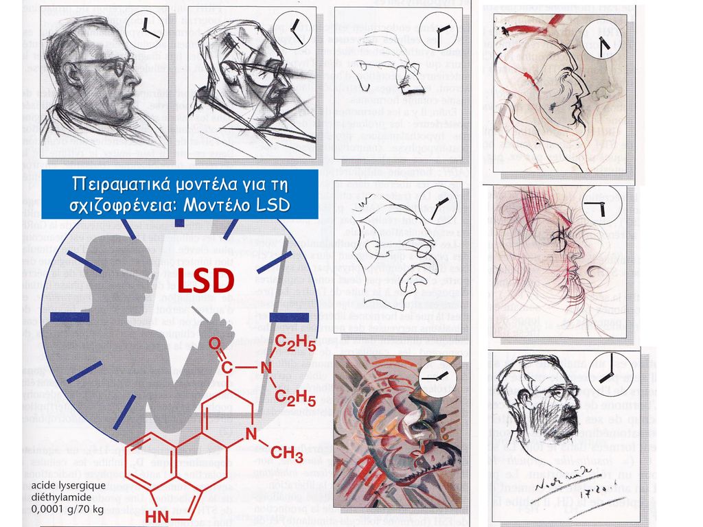 Πειραματικά μοντέλα για τη σχιζοφρένεια: Μοντέλο LSD