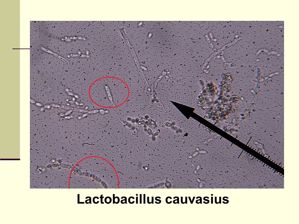 Lactobacillus cauvasius