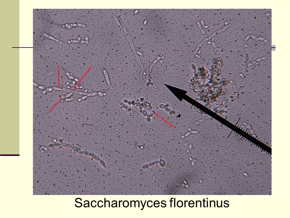 Saccharomyces florentinus