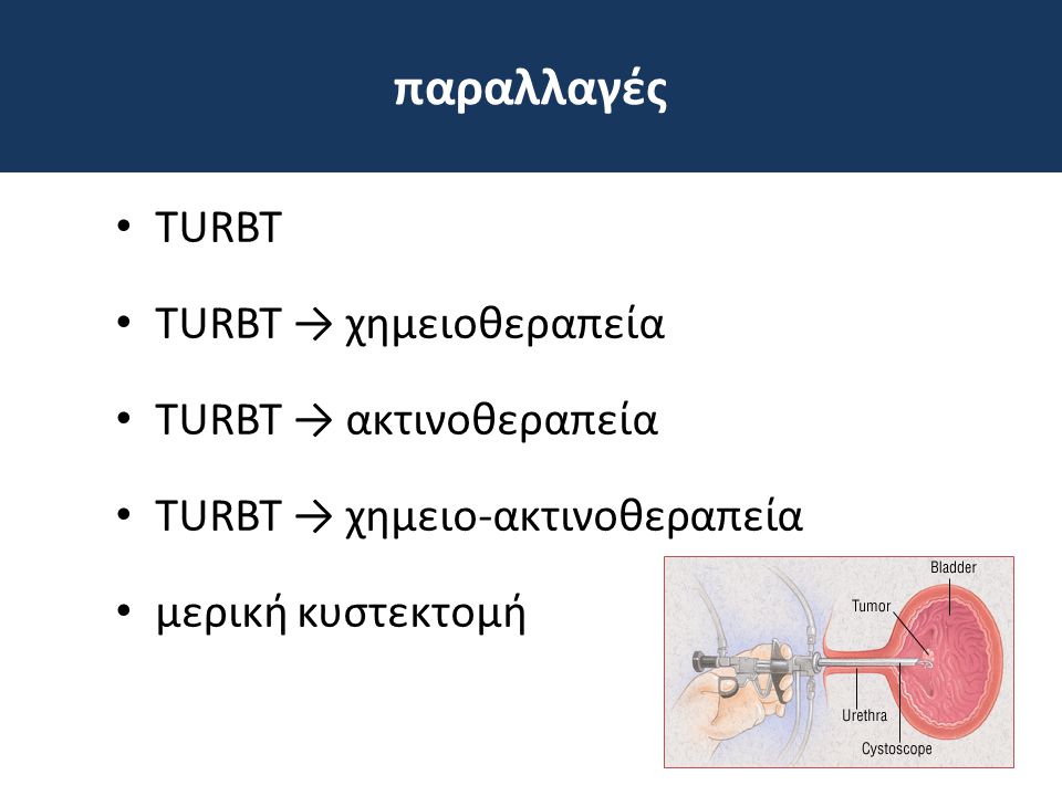 παραλλαγές TURΒΤ TURΒΤ → χημειοθεραπεία TURΒΤ → ακτινοθεραπεία