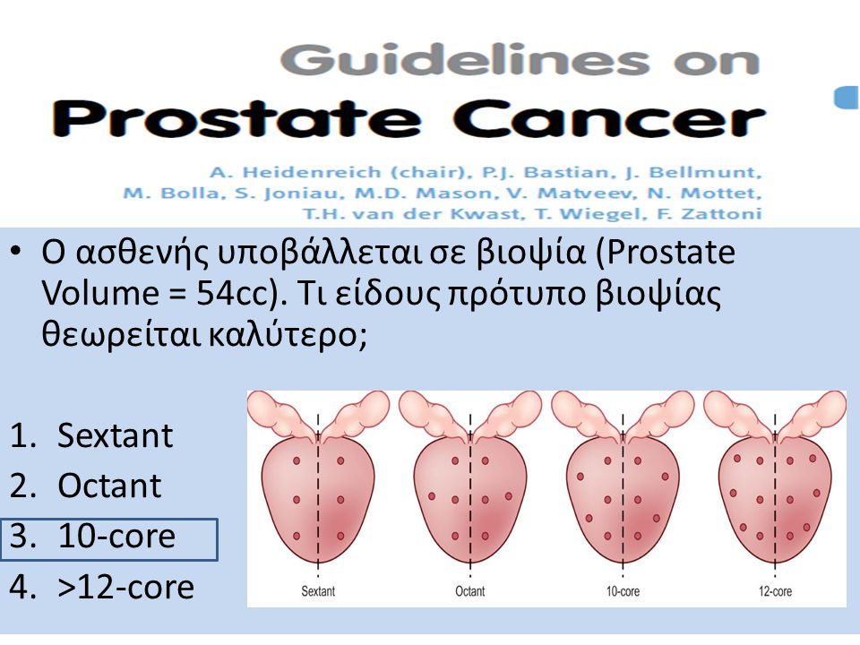 Ο ασθενής υποβάλλεται σε βιοψία (Prostate Volume = 54cc)