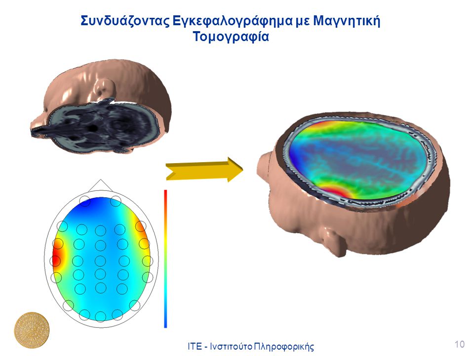 Συνδυάζοντας Εγκεφαλογράφημα με Μαγνητική Τομογραφία