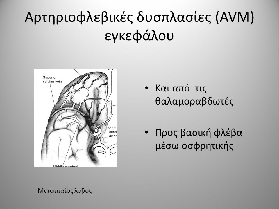 Αρτηριοφλεβικές δυσπλασίες (AVM) εγκεφάλου