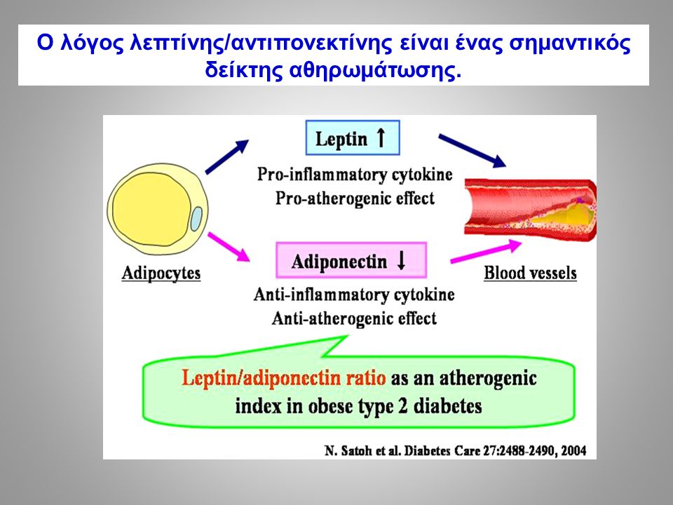 Ο λόγος λεπτίνης/αντιπονεκτίνης είναι ένας σημαντικός δείκτης αθηρωμάτωσης.