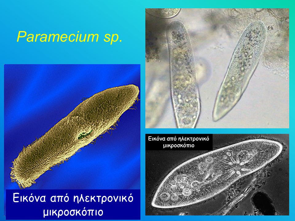 Paramecium sp. Εικόνα από ηλεκτρονικό μικροσκόπιο