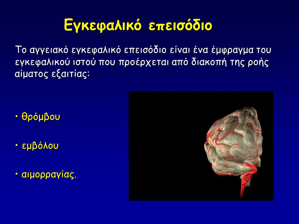 Εγκεφαλικό επεισόδιο Το αγγειακό εγκεφαλικό επεισόδιο είναι ένα έμφραγμα του εγκεφαλικού ιστού που προέρχεται από διακοπή της ροής αίματος εξαιτίας: