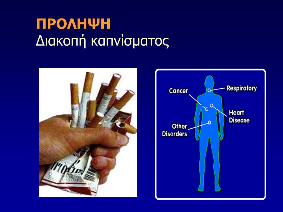 ΠΡΟΛΗΨΗ Διακοπή καπνίσματος
