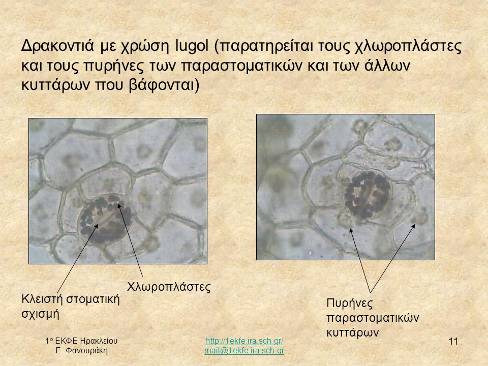 Δρακοντιά με χρώση lugol (παρατηρείται τους χλωροπλάστες και τους πυρήνες των παραστοματικών και των άλλων κυττάρων που βάφονται)