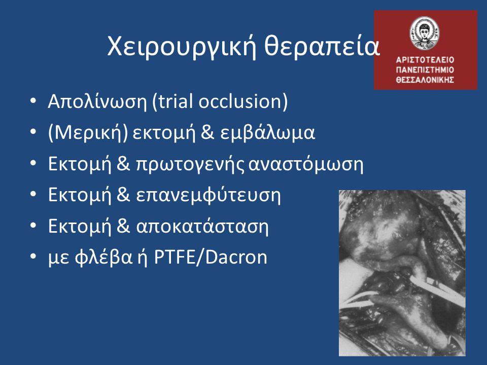 Χειρουργική θεραπεία Απολίνωση (trial occlusion)
