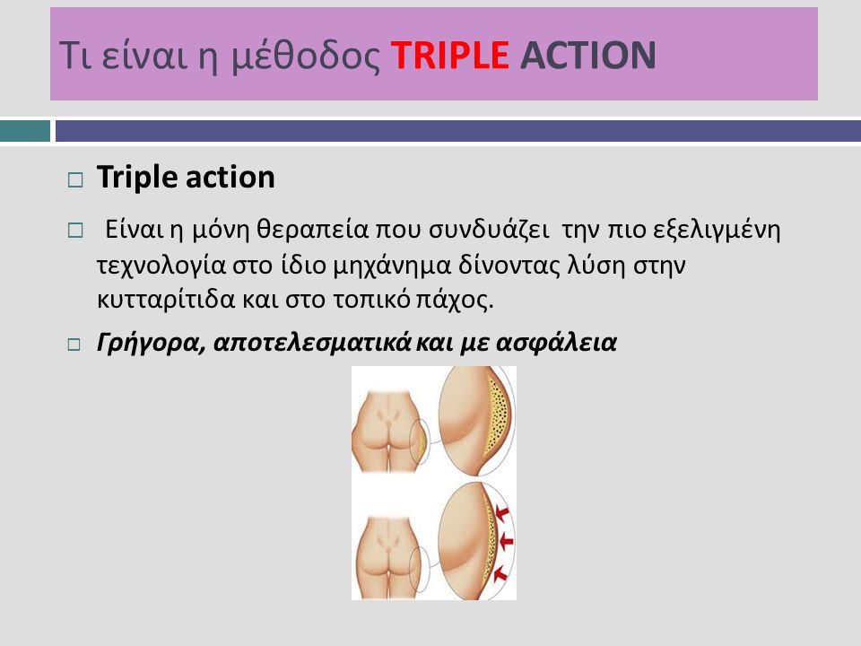 Τι είναι η μέθοδος TRIPLE ACTION