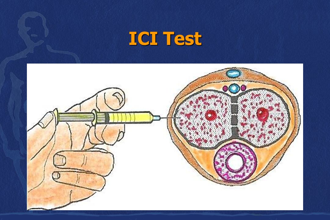 ICI Test