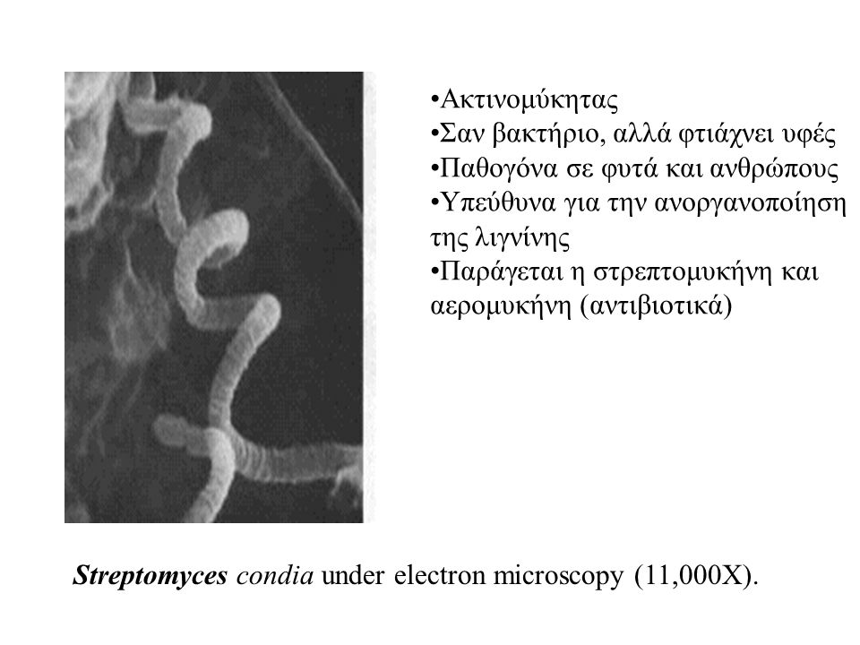 Streptomyces condia under electron microscopy (11,000X).