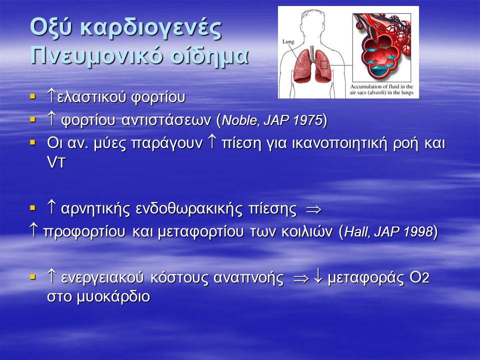 Οξύ καρδιογενές Πνευμονικό οίδημα